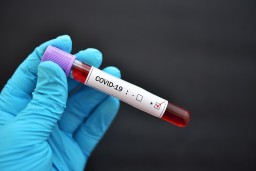 Обнаружена связь между группой крови и более тяжелым течением COVID-19