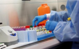 Лаборатории в Акмолинской области провели свыше 86 тысяч тестирований с 17 апреля