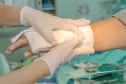 В Акмолинской области 21-летняя сотрудница предприятия получила ожоги на работе
