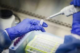 54 новых случая коронавируса выявлено в Акмолинской области за сутки