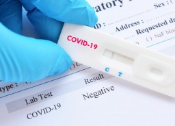 39 новых случаев COVID-19 зарегистрировано в Акмолинской области