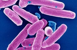 Отмечается рост заболеваемости бактериальной дизентерией в Акмолинской области