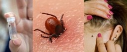 ​В Акмолинской области с жалобами на укусы клещей обратилось 50 человек