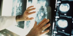 Ранняя диагностика онкопатологий в РК выросла до 30%