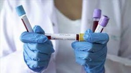 Нет данных о побочных действиях вакцин от КВИ на репродуктивную систему человека – Нариман Сыздыков