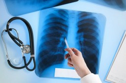 В Акмолинской области значительно сократилось количество больных туберкулезом легких