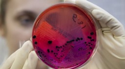 Диагноз «Сибирская язва» подтверждён в Костанае Диагноз «Сибирская язва» подтверждён в Костанае