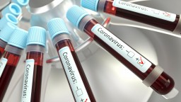 В Акмолинской области за сутки выявили 86 заразившихся COVID-19, в том числе 10 школьников