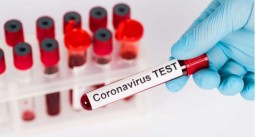 За сутки зарегистрировано 49 случаев COVID-19  в Акмолинской области