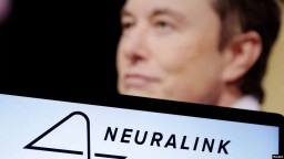 Компания Neuralink впервые имплантировала чип в мозг человека