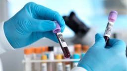 Ученые: новый метод выявления рака по анализу крови дает хорошие результаты